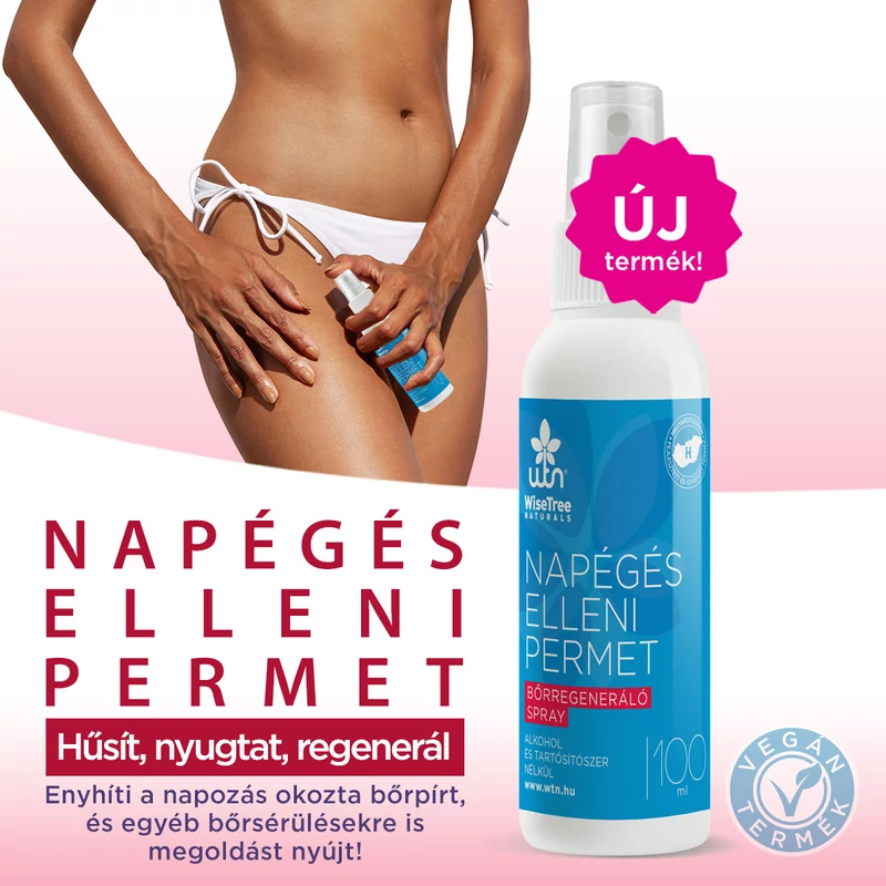Wise Tree Naturals Napégés elleni permet (100 ml)