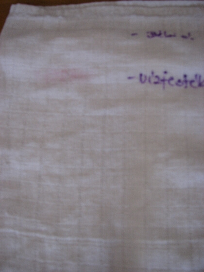 Folteltávolítás - folt 2 Folteltávolítás - folt 2