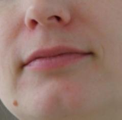 shea_teszt2_1het.jpg shea vaj teszt 1 hét