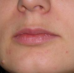 shea_teszt2_2het.jpg shea vaj teszt 2 hét