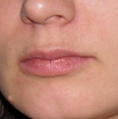 shea_teszt2_3het.jpg shea vaj teszt 3 hét