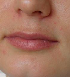 shea_teszt2_4het_01.jpg shea vaj teszt 4 hét