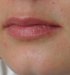 shea_teszt2_4het_02.jpg shea vaj teszt 4 hét