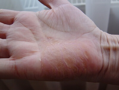 Shea vaj teszt 4 Shea vaj teszt 4