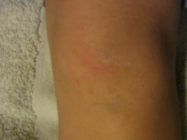 shea_vaj_1teszt_hasznalat_elott.jpg shea_vaj_1teszt_hasznalat_elott.jpg