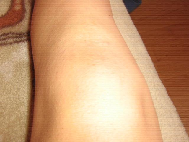 shea_vaj_1teszt_hasznalat_utan.jpg shea_vaj_1teszt_hasznalat_utan.jpg